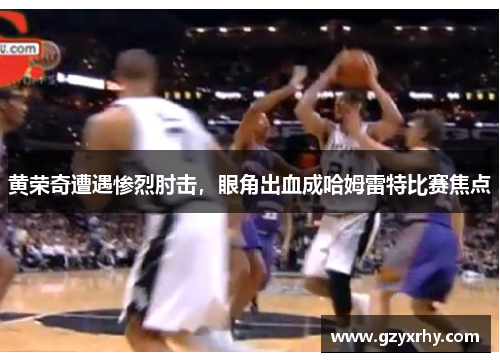 黄荣奇遭遇惨烈肘击，眼角出血成哈姆雷特比赛焦点